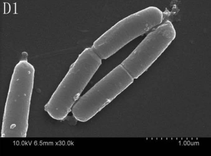 Działanie przeciwbakteryjne serycyny, Obrazy z mikroskopu elektronowego pałeczek E. coli