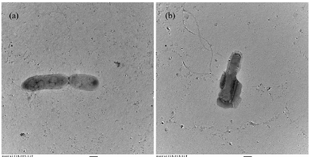 Obrazy z elektronowego mikroskopu transmisyjnego pałeczek E. coli